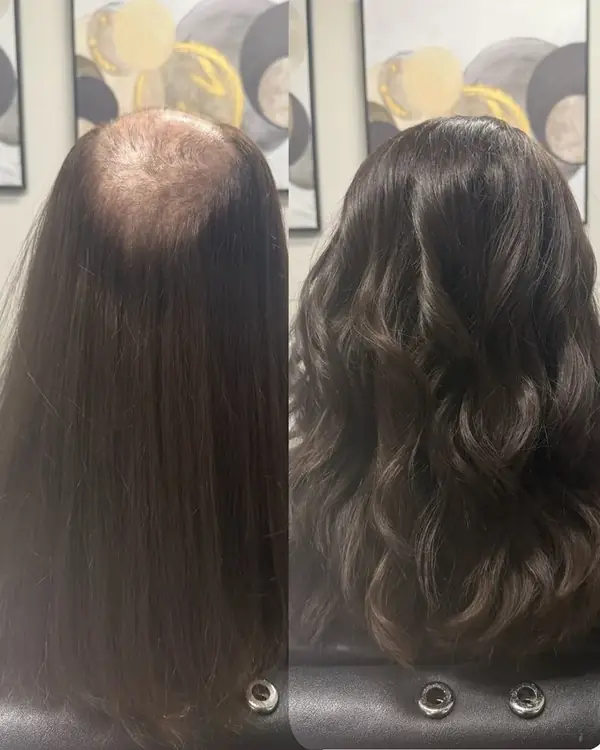 Before and after of a long-hair women’s Hair System: thin crown before, full wavy hair after